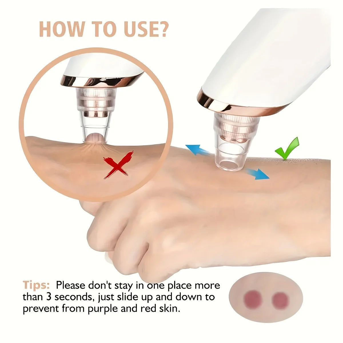 Electric Pore Vacuum Blackhead Remover – 3 Suction Levels, 5 Heads